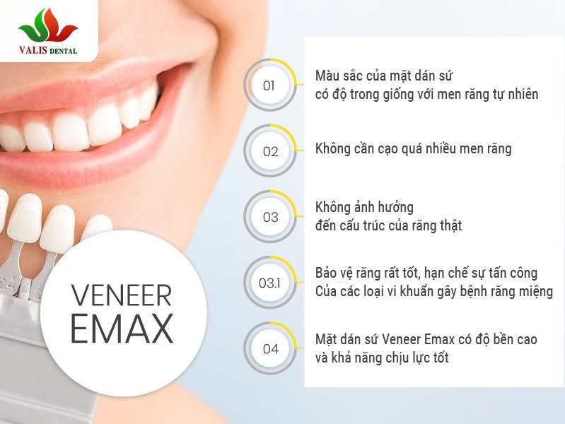 Răng sứ Veneer Emax