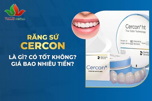 Bọc răng sứ Cercon –…