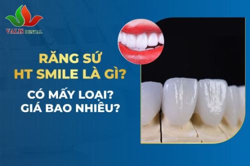 Răng sứ HT Smile –…