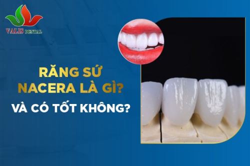 Răng sứ Nacera là gì…