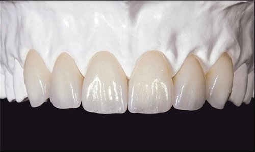 Răng sứ zirconia