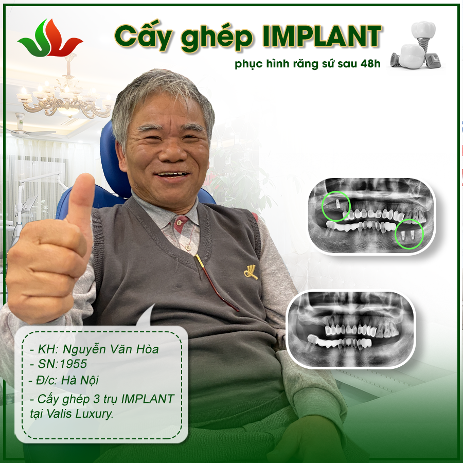 Nha khoa Valis - Địa chỉ cấy ghép Implant uy tín