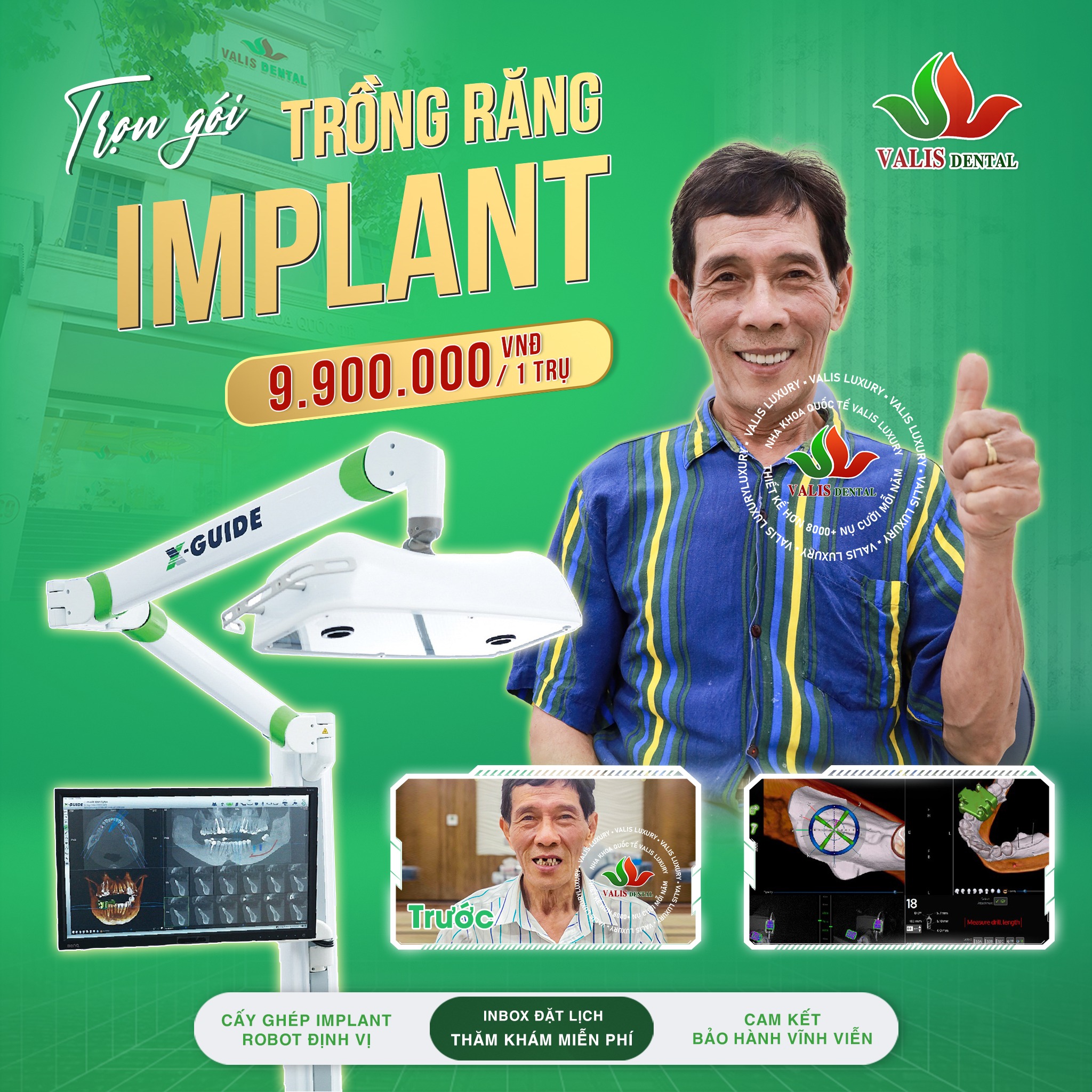 Nha khoa Valis: Địa chỉ tin cậy cho cấy ghép Implant