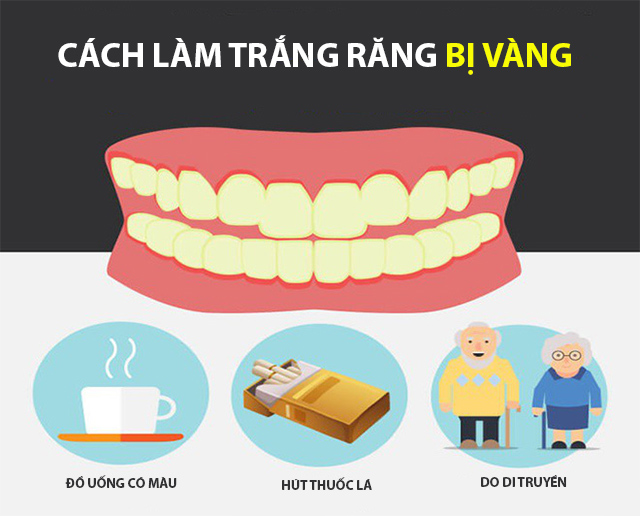 15 cách tẩy trắng răng ố vàng tại nhà đơn giản và hiệu quả