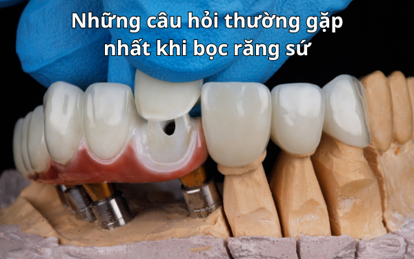 Tổng hợp