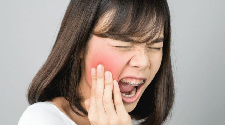 Sâu răng và cách phòng ngừa hiệu quả