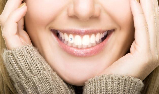 Quá trình đính kim cương hầu như không hề gây cảm giác đau đớn 