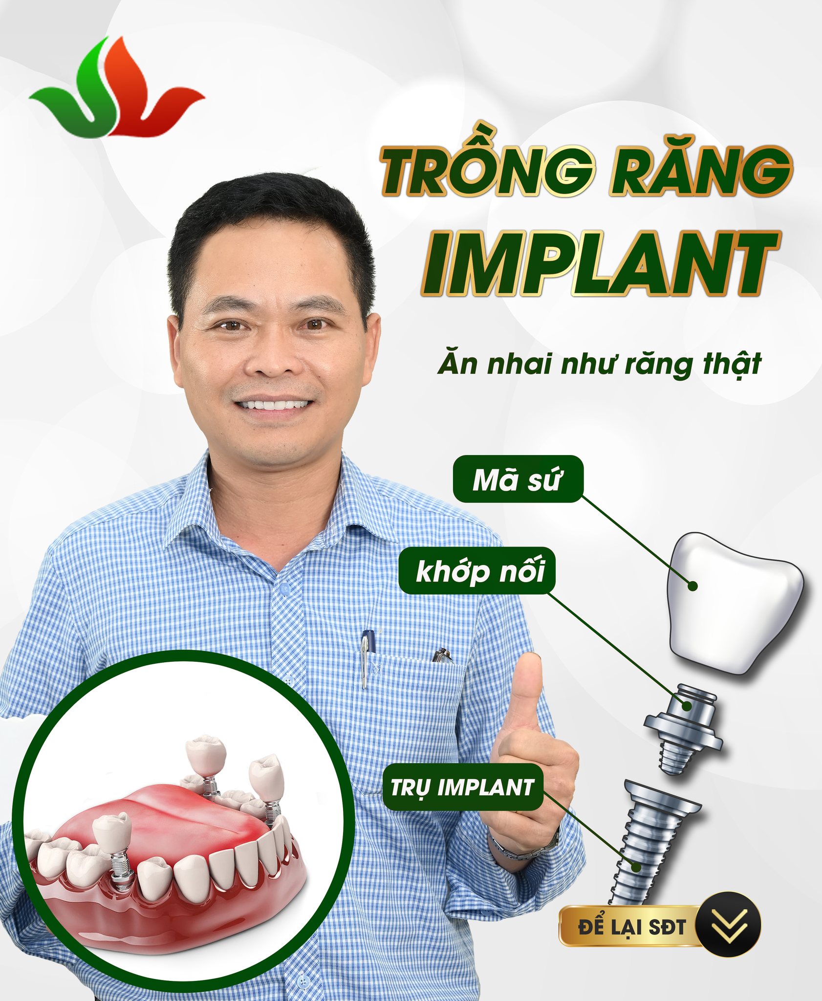 Sử dụng Implant chất lượng cao, đảm bảo độ bền và thẩm mỹ.