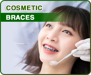 Niềng răng thay đổi khuôn mặt ra sao? Giải đáp chi tiết từ Nha khoa Valis