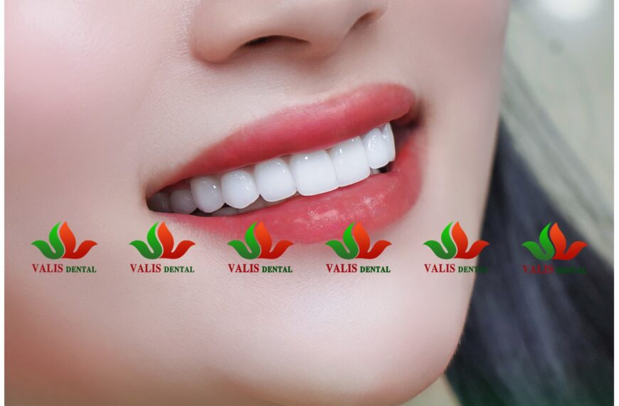 Nụ cười đẹp ảnh hưởng…