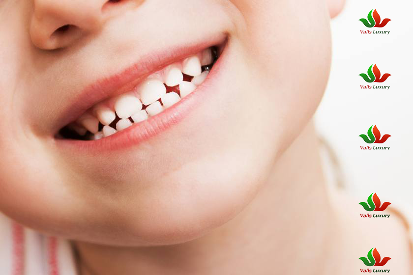When Do Baby Teeth Fall Out? A Complete Guide for Parents by Valis Luxury Dental