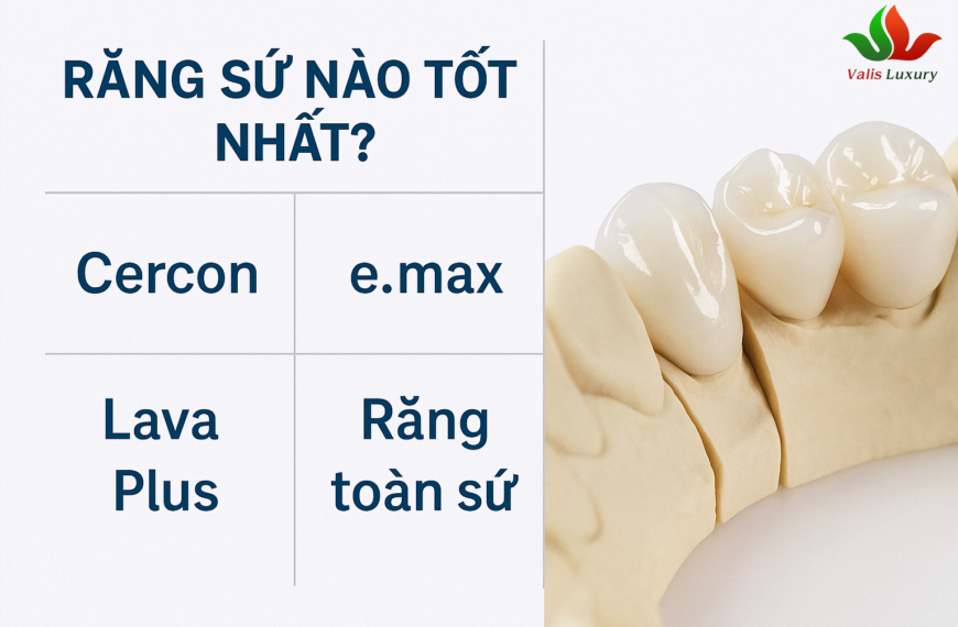 Răng sứ nào tốt nhất? So sánh Cercon, Emax, Lava Plus chi tiết từ A–Z