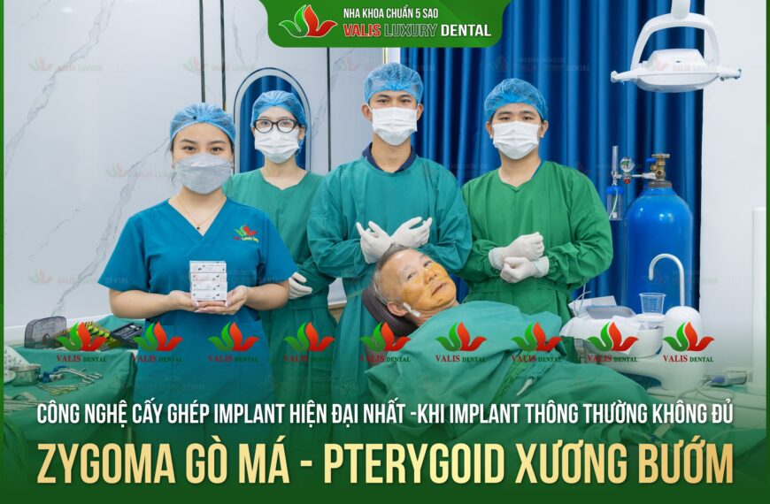 Giải Pháp Implant Toàn Diện Tại Valis Group – Khi Implant Thông Thường Là Chưa Đủ
